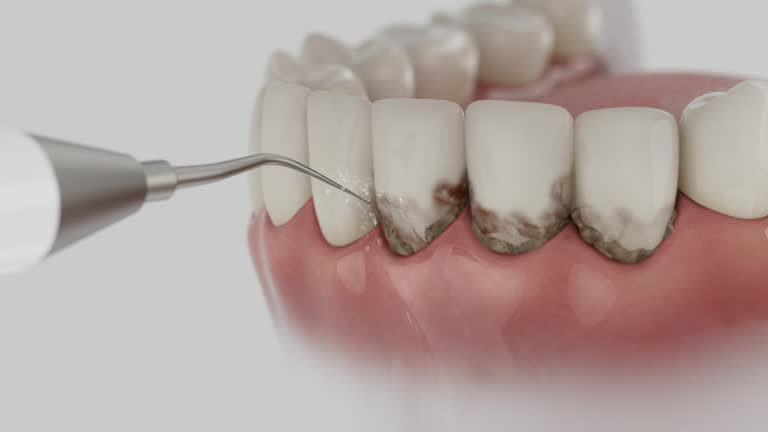 Trusted Teeth Cleaning And Checkup service in Matteson, IL - Dentist Open Now